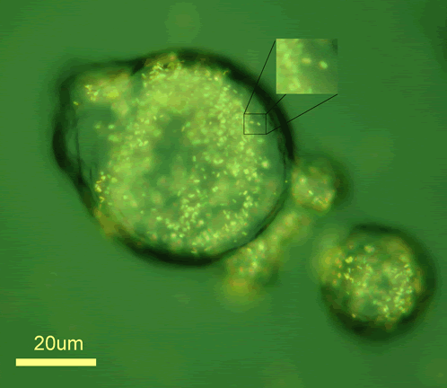 Nanopartz Cell Uptake Microgold in a Cancer Cell Imaged Using a Brigthfield Microsope with a 40x Objective